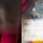 Split image shows accused Bauchi woman and injured 7-year-old child receiving treatment after alleged hot knife attack.