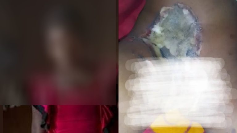 Split image shows accused Bauchi woman and injured 7-year-old child receiving treatment after alleged hot knife attack.